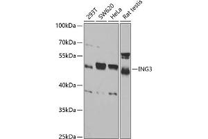 Western blot analysis of extracts of various cell lines, using ING3 antibody (ABIN6128090, ABIN6142450, ABIN6142451 and ABIN6221526) at 1:1000 dilution. (ING3 抗体  (AA 1-92))