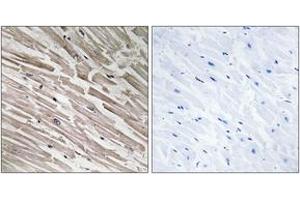 Immunohistochemistry analysis of paraffin-embedded human heart tissue, using MRPL44 Antibody. (MRPL44 抗体  (AA 221-270))
