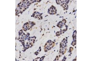 Immunohistochemistry (IHC) image for anti-Regulator of Calcineurin 1 (RCAN1) antibody (ABIN1876514) (RCAN1 抗体)