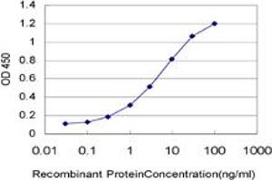 Detection limit for recombinant GST tagged RCV1 is approximately 0. (Recoverin 抗体  (AA 101-199))