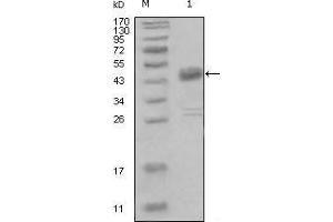 Western Blot showing DDR1 antibody used against truncated MBP-DDR1 recombinant protein (1). (DDR1 抗体  (AA 602-681))