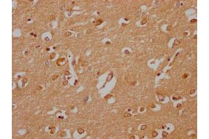 IHC image of ABIN7142045 diluted at 1:200 and staining in paraffin-embedded human brain tissue performed on a Leica BondTM system. (Phospholipase C beta 2 抗体  (AA 1031-1185))