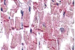 Human Heart: Formalin-Fixed, Paraffin-Embedded (FFPE) (Vinculin 抗体  (AA 452-701))