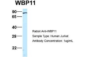 Host:  Rabbit  Target Name:  WB Sample Type:  Jurkat  Antibody Dilution:  1. (WBP11 抗体  (N-Term))