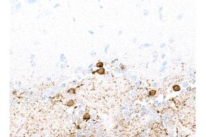 Immunohistochemistry (IHC) image for anti-Tyrosine Hydroxylase (TH) (AA 450-500) antibody (ABIN7449433)