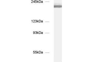 dilution: 1 : 1000, sample: mouse brain homogenate (NCAM 180 (AA 1-1115) 抗体)