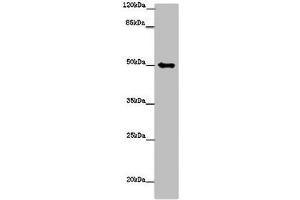 Western blot All lanes: TUBG1 antibody at 14 μg/mL + Hela whole cell lysate Secondary Goat polyclonal to rabbit IgG at 1/10000 dilution Predicted band size: 52 kDa Observed band size: 52 kDa (TUBG1 抗体  (AA 29-184))