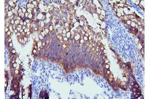 IHC analysis of PYROXD1 using anti-PYROXD1 antibody (ABIN6719650). (PYROXD1 抗体  (AA 48-230))