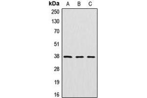 Western blot analysis of Cathepsin V expression in HeLa (A), mouse kidney (B), rat kidney (C) whole cell lysates. (Cathepsin L2 抗体  (Center))