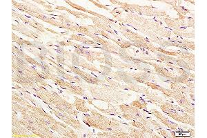 Formalin-fixed and paraffin embedded rat heart tissue labeled with Anti-phospho-ASK1(Thr845) Polyclonal Antibody, Unconjugated (ABIN683128) at 1:200 followed by conjugation to the secondary antibody, (SP-0023), and DAB staining (ASK1 抗体  (pThr845))