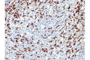 Formalin-fixed, paraffin-embedded human Tonsil stained with PD1 (CD279) Rabbit Polyclonal Antibody. (PD-1 抗体)