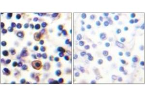 Immunohistochemistry analysis of paraffin-embedded human lymph node, using IL-9R (Phospho-Ser519) Antibody. (IL9 Receptor 抗体  (pSer519))