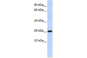 WB Suggested Anti-HSD17B14 Antibody Titration: 0. (HSD17B14 抗体  (Middle Region))