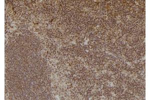ABIN6276920 at 1/100 staining Mouse spleen tissue by IHC-P. (Liver Arginase 抗体  (C-Term))