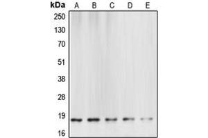 Western blot analysis of Caspase 6 p18 expression in HeLa (A), mouse brain (B), rat kidney (C), NIH3T3 staurosporine-treated (D), Jurkat etoposide-treated (E) whole cell lysates. (Caspase 6 p18 (Center) 抗体)