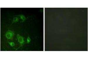 Immunofluorescence analysis of HuvEc cells, using EGFR (Ab-693) Antibody. (EGFR 抗体  (AA 661-710))