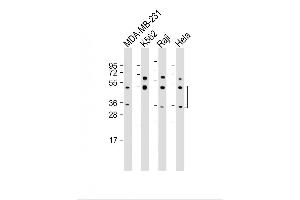 Western Blotting (WB) image for anti-Caspase 5, Apoptosis-Related Cysteine Peptidase (CASP5) (AA 162-191) antibody (ABIN654898)