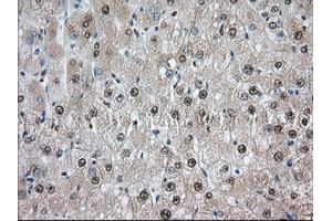 Image no. 8 for anti-Transforming, Acidic Coiled-Coil Containing Protein 3 (TACC3) antibody (ABIN1498097) (TACC3 抗体)