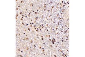 Immunohistochemistry (Paraffin-embedded Sections) (IHC (p)) image for anti-Signal Recognition Particle 14kDa (Homologous Alu RNA Binding Protein) (SRP14) antibody (ABIN7075596)