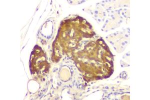 IHC analysis of ATP citrate lyase using anti-ATP citrate lyase antibody (ABIN6719406). (ACLY 抗体  (AA 1-180))