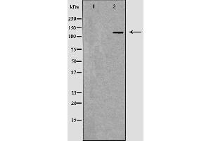 Western blot analysis of Hela whole cell lysates, using MSH3 Antibody. (MSH3 抗体  (N-Term))