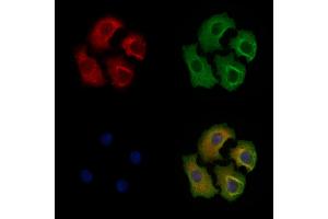 Phospho-eIF4B (Ser504) Antibody staining Hela cells(heat shock treatment) by IF/ICC. (EIF4B 抗体  (pSer504))
