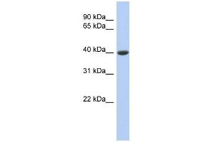 Carboxypeptidase B1 antibody used at 1 ug/ml to detect target protein. (CPB1 抗体)