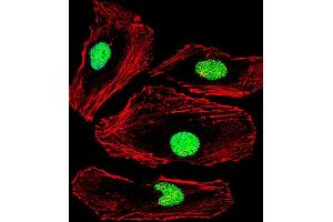 Fluorescent confocal image of Hela cell stained with MBD2 Antibody (Center) (ABIN1881531 and ABIN2838849). (MBD2 抗体  (AA 250-279))