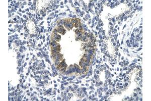 Rabbit Anti-TP53 antibody Catalog Number: AVARP02055  Paraffin Embedded Tissue: Human Lung cell Cellular Data: bronchiole epithelium of renal tubule Antibody Concentration: 4. (p53 抗体  (C-Term))