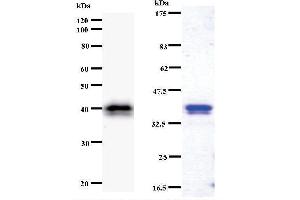 Left: CHD1L staining. (CHD1L 抗体)