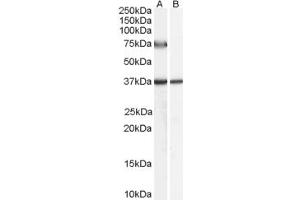 Western Blotting (WB) image for anti-Acyl-CoA Oxidase 2, Branched Chain (Acox2) (AA 651-664) antibody (ABIN291240) (Acox2 抗体  (AA 651-664))