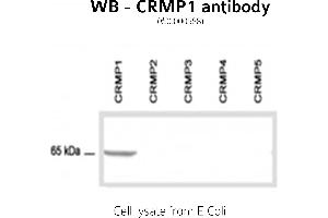 Image no. 2 for anti-GABA Transporter 1 (GAT1) (C-Term) antibody (ABIN346940) (SLC6A1 抗体  (C-Term))