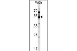 Western blot analysis in WiDr cell line lysates (35ug/lane). (GPR84 抗体  (AA 265-293))