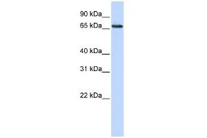 WB Suggested Anti-WDSOF1 Antibody Titration: 0.