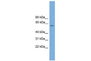 WB Suggested Anti-ZBTB46 Antibody Titration:  0.
