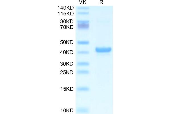 APOA5 Protein (AA 21-368) (His tag)