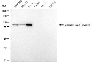 Western blotting analysis using Glucocorticoid Receptor antibody (ABIN7799658).
