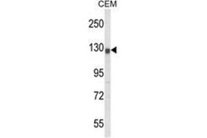 Western blot analysis of KCNH2 Antibody (Center) in CEM cell line lysates (35ug/lane).