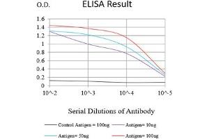 Black line: Control Antigen (100 ng),Purple line: Antigen (10 ng), Blue line: Antigen (50 ng), Red line:Antigen (100 ng) (HAS1 抗体)