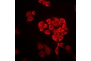 Immunofluorescent analysis of DHRS9 staining in Hela cells. (DHRS9 抗体)