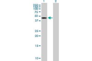 Western Blot analysis of ZMYND10 expression in transfected 293T cell line by ZMYND10 MaxPab polyclonal antibody. (ZMYND10 抗体  (AA 1-440))