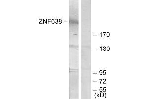 Western blot analysis of extracts from HepG2 cells, treated with serum (20%, 15mins), using ZNF638 antibody. (ZNF638 抗体  (Internal Region))