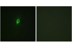 Immunofluorescence analysis of NIH-3T3 cells, using eIF4B (Phospho-Ser422) Antibody. (EIF4B 抗体  (pSer422))