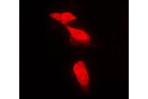 Immunofluorescent analysis of PPP2R5A staining in NIH3T3 cells. (PPP2R5A 抗体  (Center))