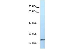 Western Blot showing EFNA2 antibody used at a concentration of 1 ug/ml against Placenta Lysate (Ephrin A2 抗体  (Middle Region))