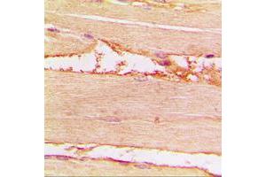 Immunohistochemical analysis of Merlin (pS518) staining in human muscle formalin fixed paraffin embedded tissue section. (Merlin 抗体  (C-Term, pSer518))