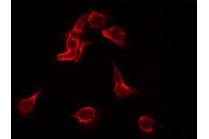 ABIN6267415 staining Hela by IF/ICC. (FLT1 抗体  (pTyr1213))