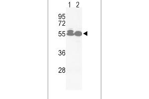 Western blot analysis of hACVRL1-L489 in Jurkat(lane 1), HepG2(lane 2) cell line lysates (35ug/lane) (ACVRL1 抗体  (C-Term))