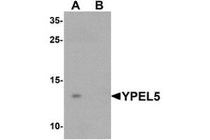 Western blot analysis of YPEL5 in A-20 cell lysate with YPEL5 Antibody  at 1 ug/mL in (A) the absence and (B) the presence of blocking peptide. (YPEL5 抗体  (N-Term))