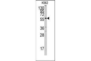 Image no. 1 for anti-Cytochrome P450, Family 7, Subfamily A, Polypeptide 1 (CYP7A1) (C-Term) antibody (ABIN360417)